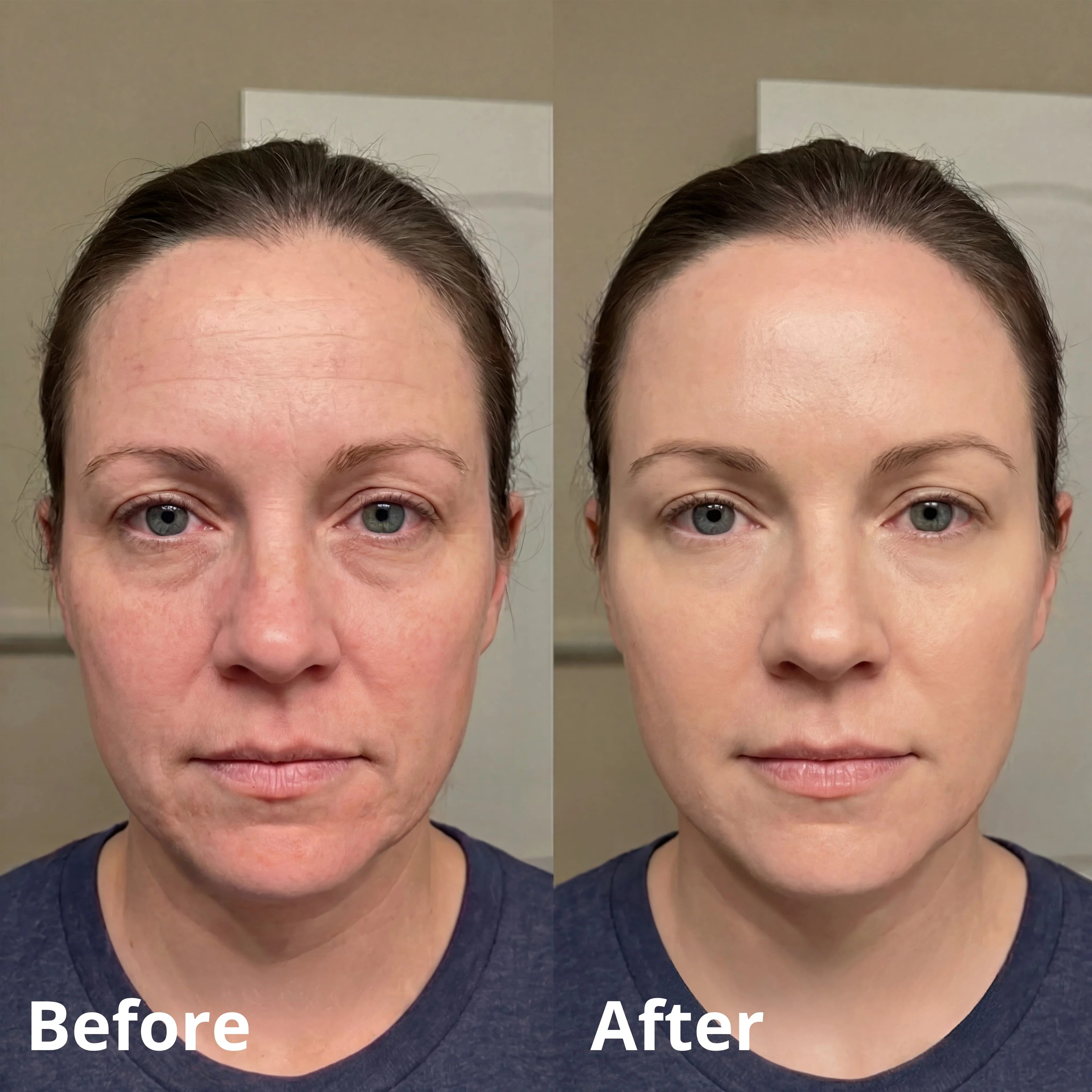 Glora Pink Collagen Volume Balm Stick