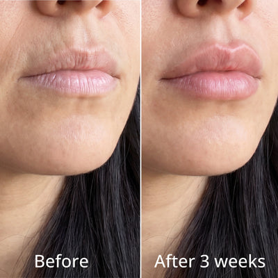 Glora Pink Collagen Volume Balm Stick